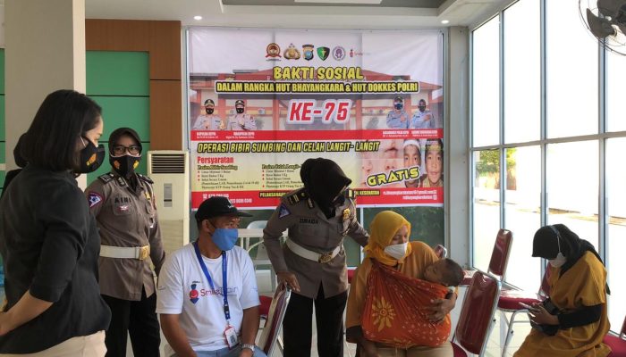 Operasi Bibir Sumbing Peringati HUT Bhayangkara Dan Dokkes Polri Ke-75