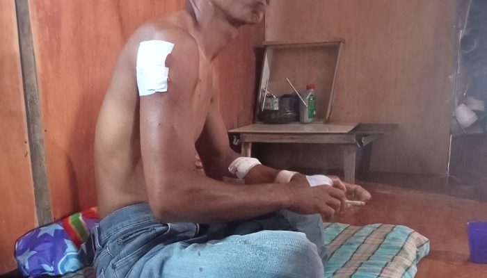 Buka Mulut Buaya, Nelayan Pencari Kepiting di Tanjungpinang Lolos Dari Maut