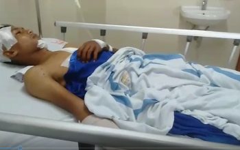 Nelayan Sebauk Tanjungpinang Diterkam Buaya, Berhasil Lolos dengan Luka Serius 