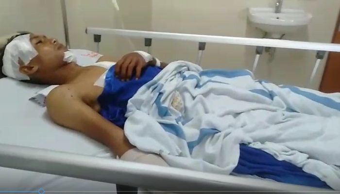 Nelayan Sebauk Tanjungpinang Diterkam Buaya, Berhasil Lolos dengan Luka Serius 